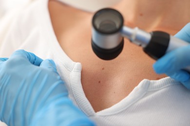 Photo of Doctor examining young woman's mole with dermatoscope in hospital, closeup