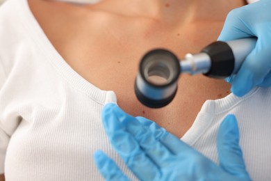 Photo of Doctor examining young woman's mole with dermatoscope in hospital, closeup