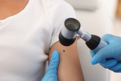 Photo of Doctor examining young woman's mole with dermatoscope in hospital, closeup