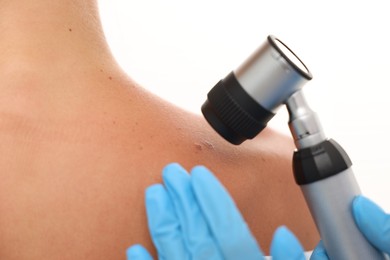 Photo of Doctor examining young woman's mole with dermatoscope on white background, closeup