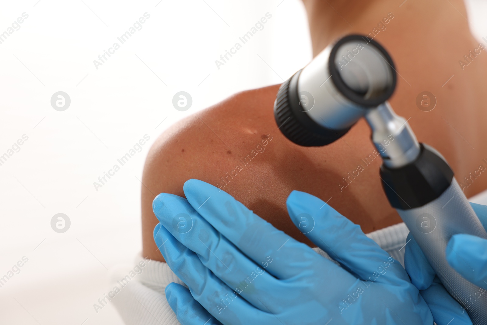 Doctor examining young woman's mole with dermatoscope on white background, closeup Photo of Doctor examining young woman's mole with dermatoscope on white background, closeup