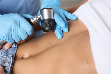 Photo of Doctor examining young woman's mole with dermatoscope in hospital, closeup