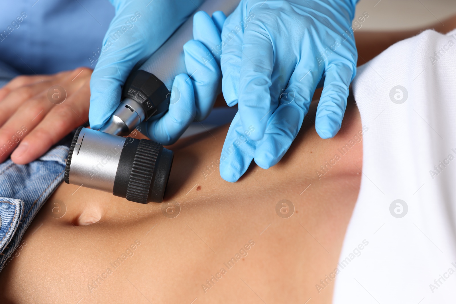 Photo of Doctor examining young woman's mole with dermatoscope in hospital, closeup