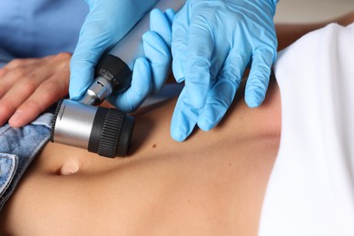 Photo of Doctor examining young woman's mole with dermatoscope in hospital, closeup