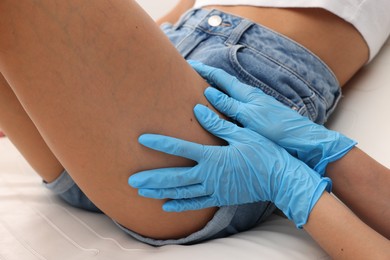 Photo of Doctor examining young woman's mole in hospital, closeup