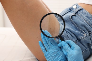 Photo of Doctor examining young woman's mole with magnifying glass in hospital, closeup