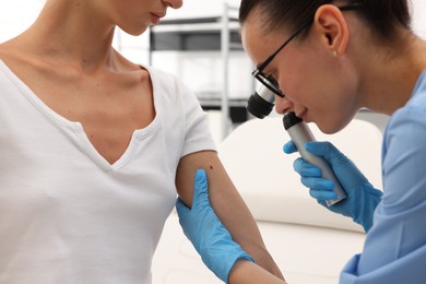 Photo of Doctor examining young woman's mole with dermatoscope in hospital