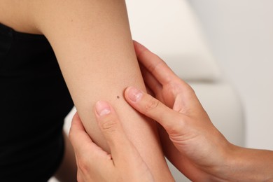 Photo of Doctor examining young woman's mole in hospital, closeup