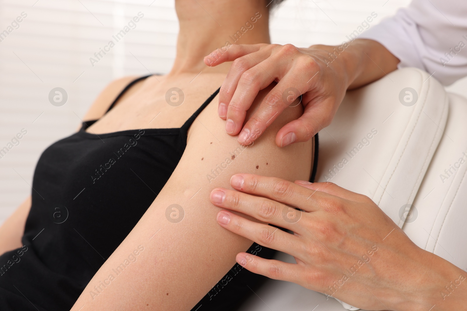 Doctor examining young woman's mole in hospital, closeup Photo of Doctor examining young woman's mole in hospital, closeup