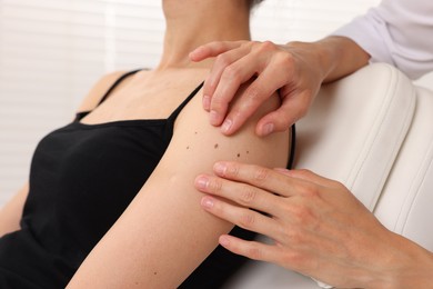 Photo of Doctor examining young woman's mole in hospital, closeup