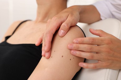 Photo of Doctor examining young woman's mole in hospital, closeup