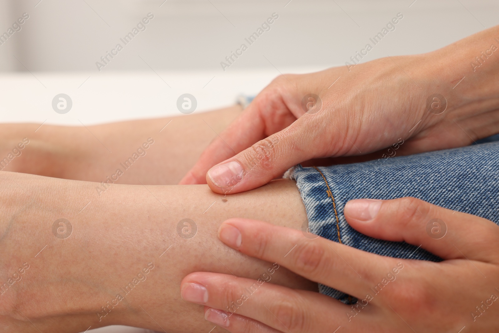 Doctor examining young woman's mole in hospital, closeup Photo of Doctor examining young woman's mole in hospital, closeup