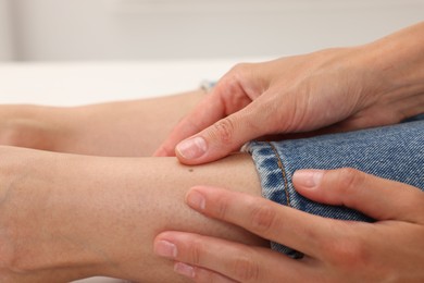 Photo of Doctor examining young woman's mole in hospital, closeup