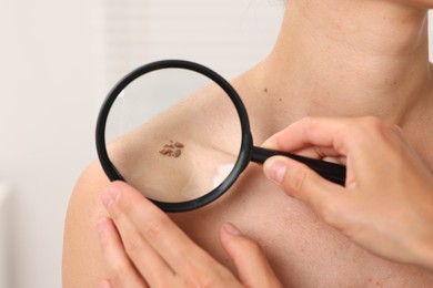 Photo of Doctor examining young woman's mole with magnifying glass in hospital, closeup
