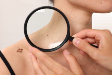Photo of Doctor examining young woman's mole with magnifying glass in hospital, closeup