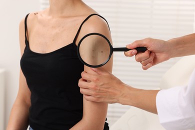 Photo of Doctor examining young woman's mole with magnifying glass in hospital, closeup