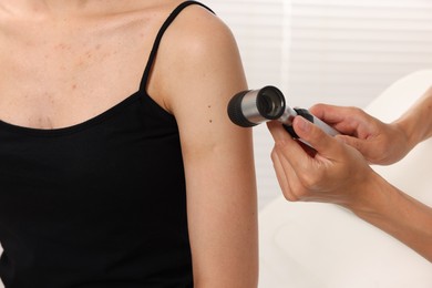 Photo of Doctor examining young woman's mole with dermatoscope in hospital, closeup