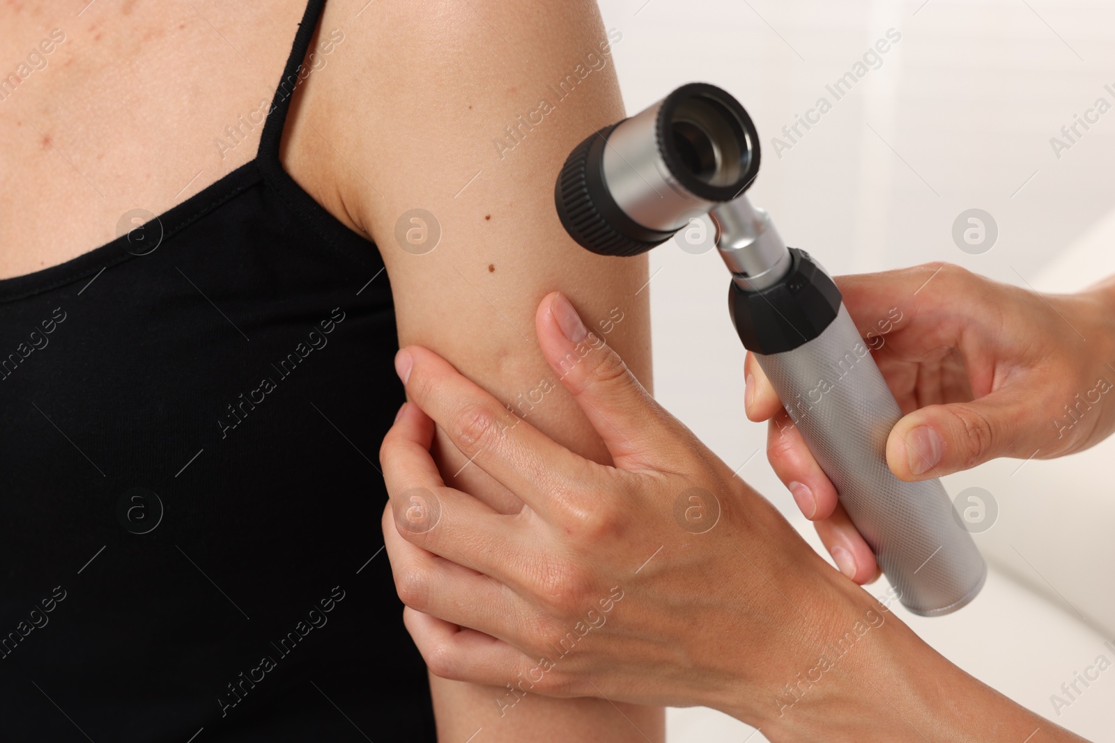 Doctor examining young woman's mole with dermatoscope in hospital, closeup Photo of Doctor examining young woman's mole with dermatoscope in hospital, closeup