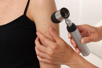Photo of Doctor examining young woman's mole with dermatoscope in hospital, closeup