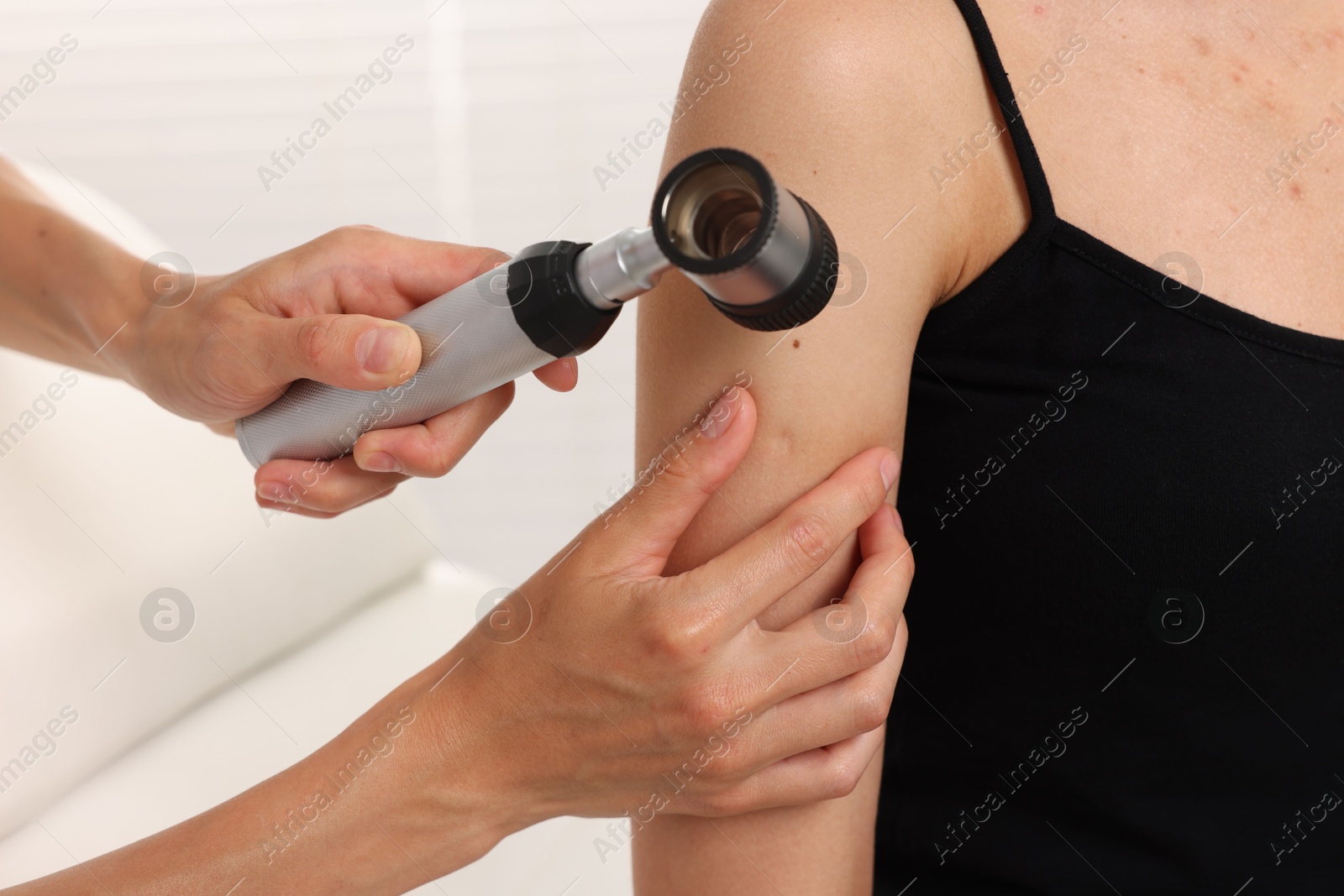 Doctor examining young woman's mole with dermatoscope in hospital, closeup Photo of Doctor examining young woman's mole with dermatoscope in hospital, closeup