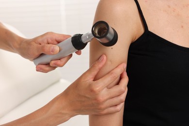 Photo of Doctor examining young woman's mole with dermatoscope in hospital, closeup