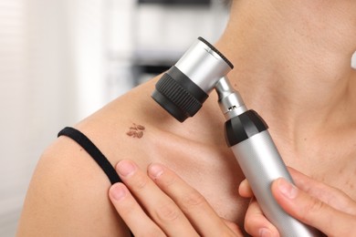 Photo of Doctor examining young woman's mole with dermatoscope in hospital, closeup