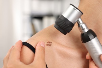 Photo of Doctor examining young woman's mole with dermatoscope in hospital, closeup