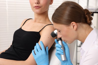 Photo of Doctor examining young woman's mole with dermatoscope in hospital
