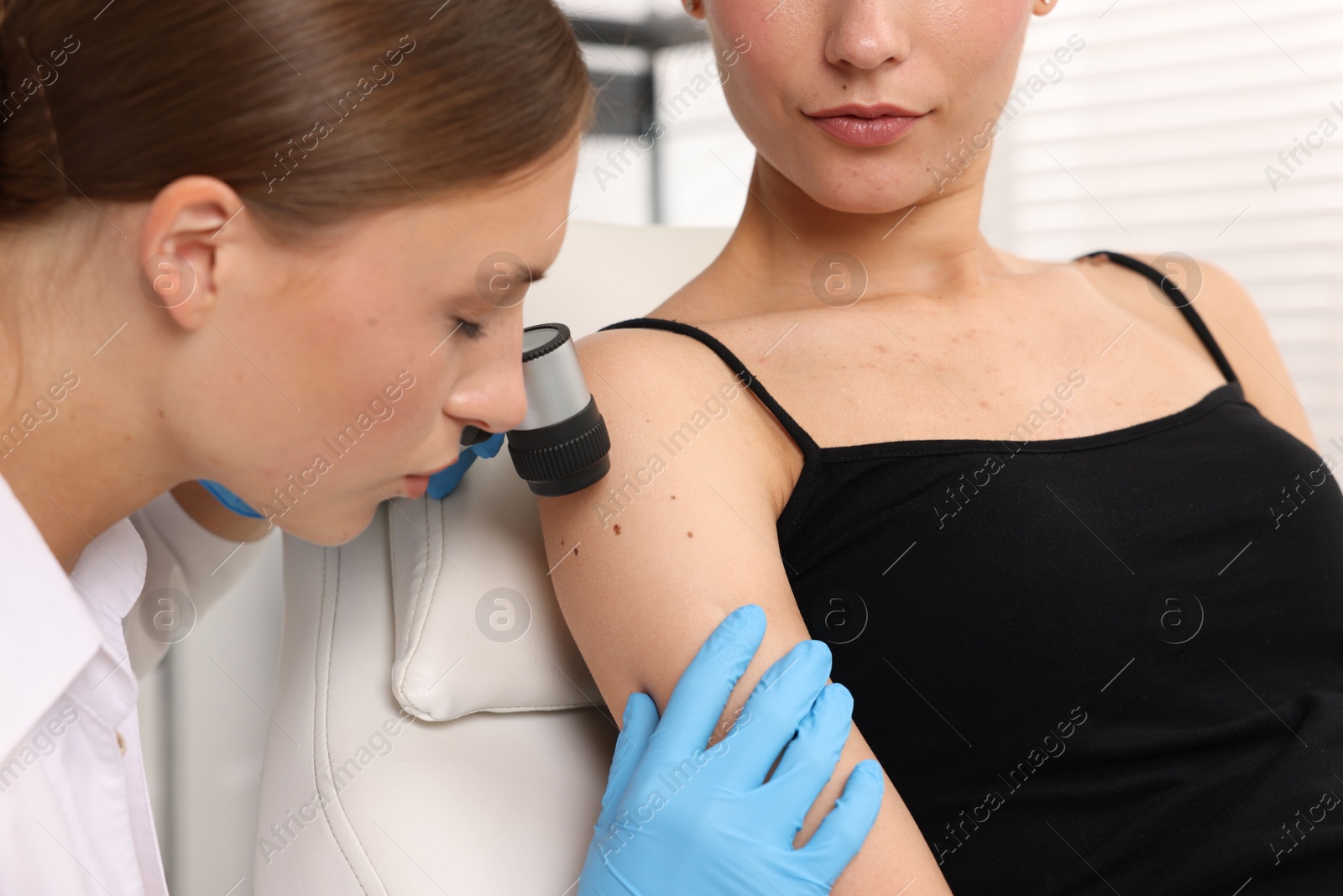Photo of Doctor examining young woman's mole with dermatoscope in hospital, closeup