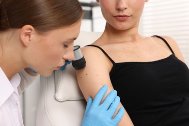 Photo of Doctor examining young woman's mole with dermatoscope in hospital, closeup