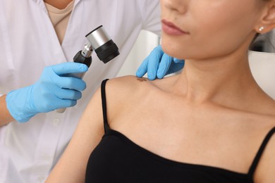 Photo of Doctor examining young woman's mole with dermatoscope in hospital, closeup