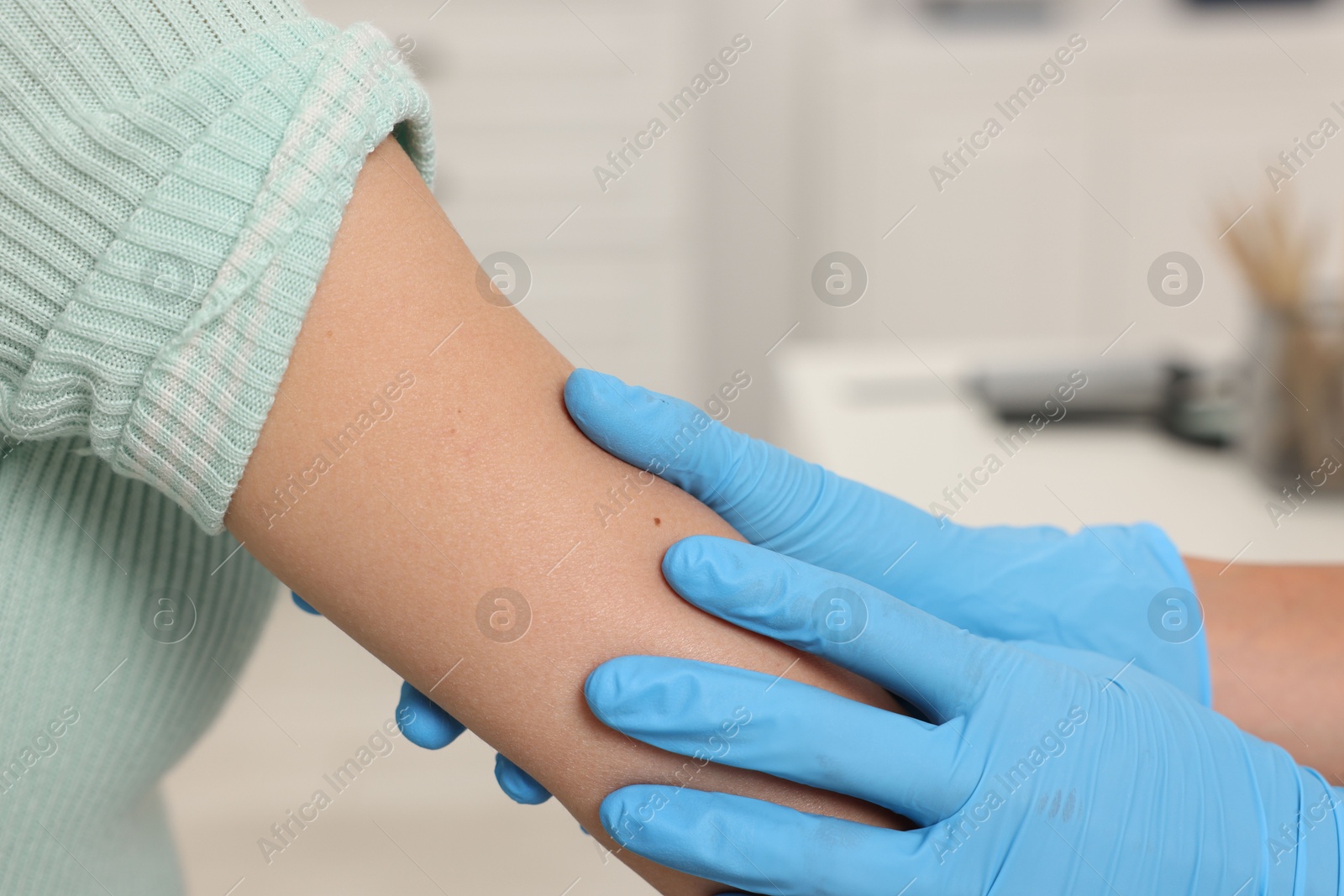 Doctor examining young woman's mole in hospital, closeup Photo of Doctor examining young woman's mole in hospital, closeup