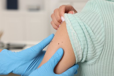 Photo of Doctor examining young woman's mole in hospital, closeup