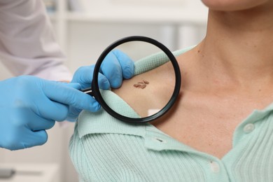 Photo of Doctor examining young woman's mole with magnifying glass in hospital, closeup