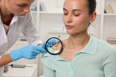 Photo of Doctor examining young woman's mole with magnifying glass in hospital