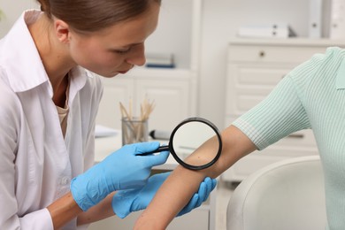 Photo of Doctor examining young woman's mole with magnifying glass in hospital, closeup