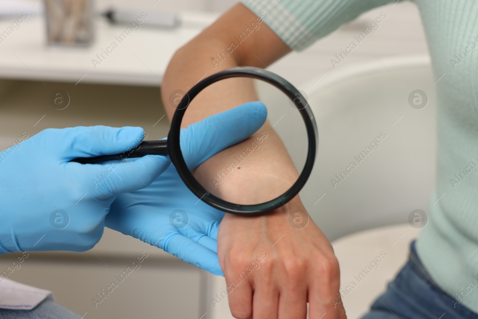 Doctor examining young woman's mole with magnifying glass in hospital, closeup Photo of Doctor examining young woman's mole with magnifying glass in hospital, closeup