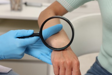 Photo of Doctor examining young woman's mole with magnifying glass in hospital, closeup