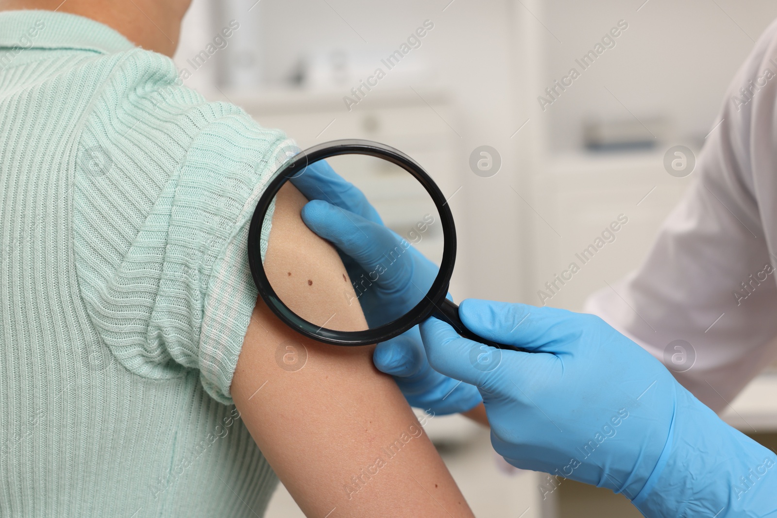 Photo of Doctor examining young woman's mole with magnifying glass in hospital, closeup