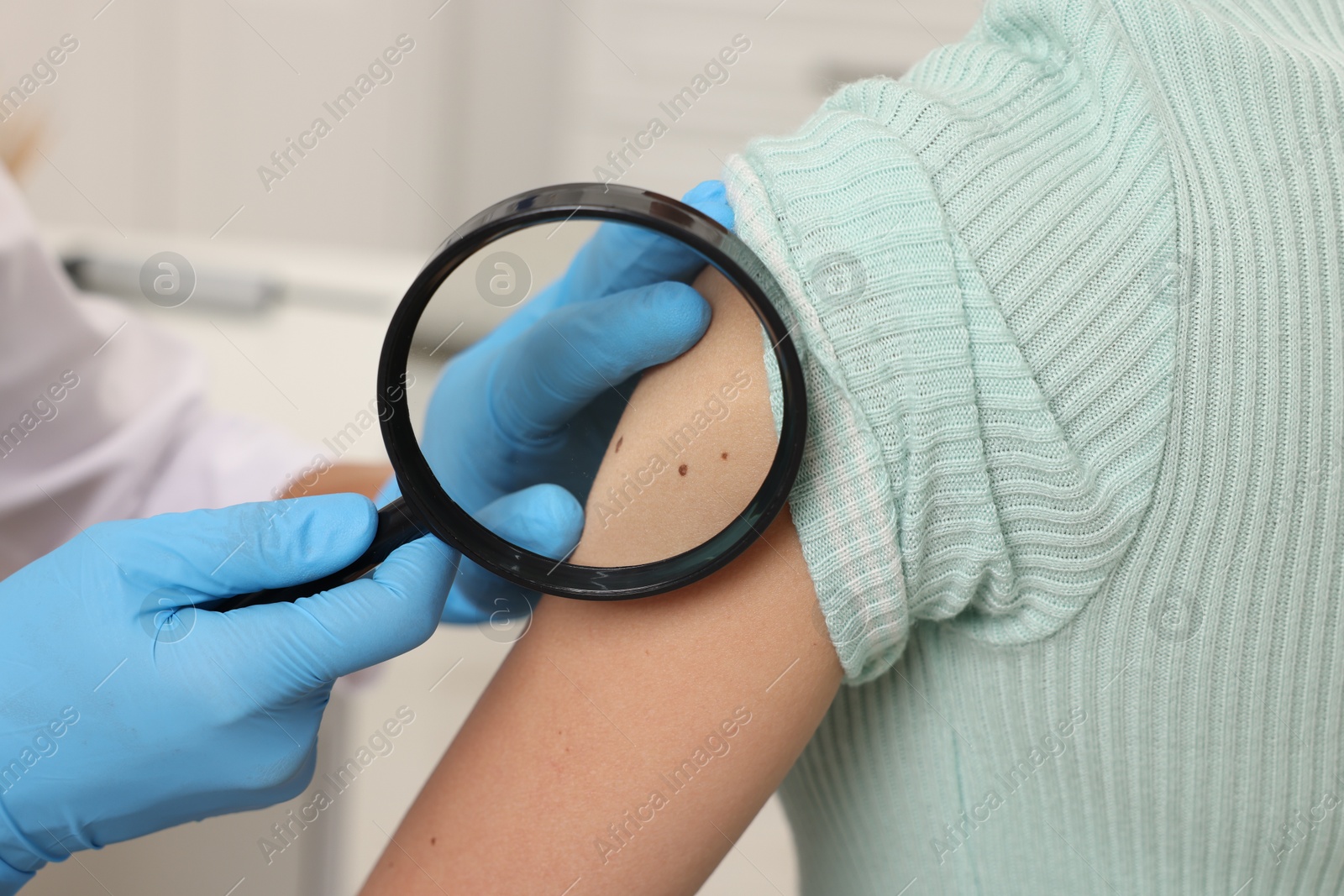 Photo of Doctor examining young woman's mole with magnifying glass in hospital, closeup