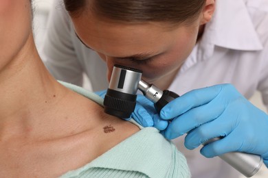 Photo of Doctor examining young woman's mole with dermatoscope in hospital, closeup