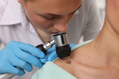 Photo of Doctor examining young woman's mole with dermatoscope in hospital, closeup