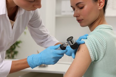 Photo of Doctor examining young woman's mole with dermatoscope in hospital