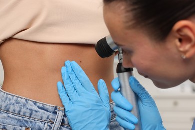 Photo of Doctor examining young woman's mole with dermatoscope in hospital, closeup