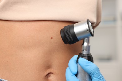 Photo of Doctor examining young woman's mole with dermatoscope in hospital, closeup