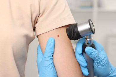 Photo of Doctor examining young woman's mole with dermatoscope in hospital, closeup