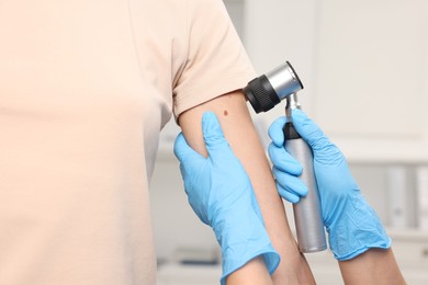 Photo of Doctor examining young woman's mole with dermatoscope in hospital, closeup