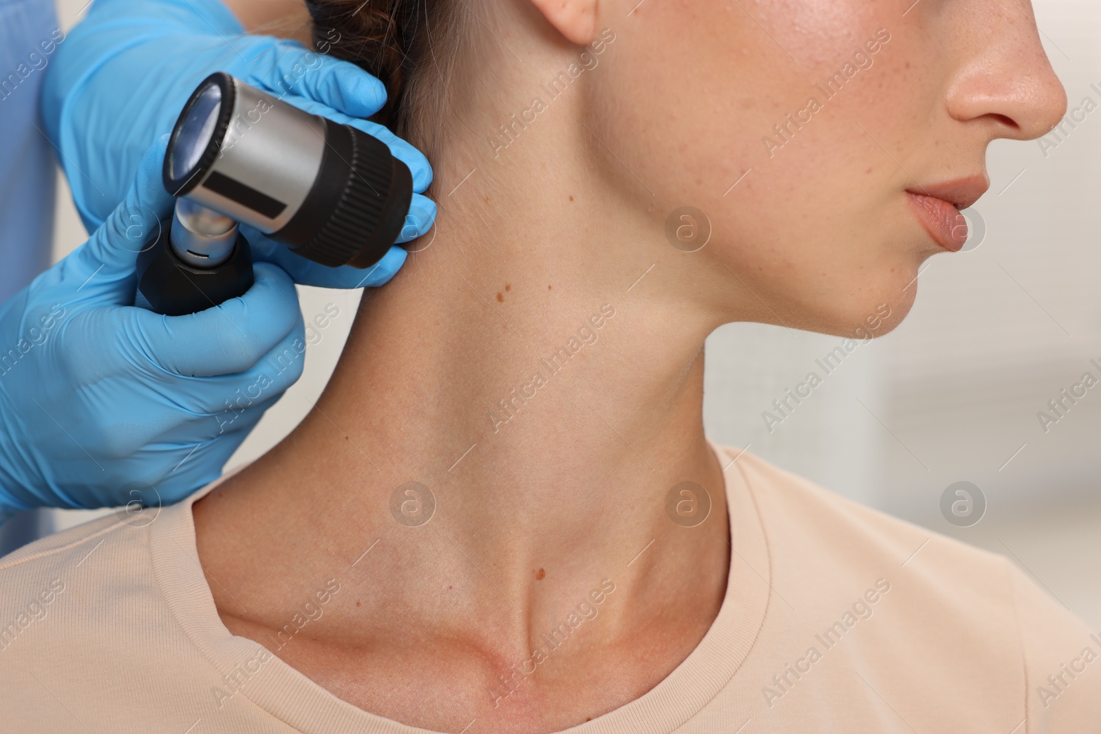 Photo of Doctor examining young woman's mole with dermatoscope in hospital, closeup