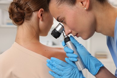Photo of Doctor examining young woman's mole with dermatoscope in hospital, closeup