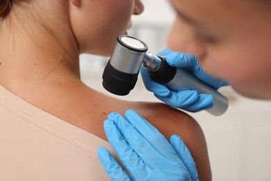 Photo of Doctor examining young woman's mole with dermatoscope in hospital, closeup